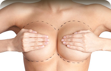 Αυξητική στήθους - πλαστικός χειρούργος ιωάννινα