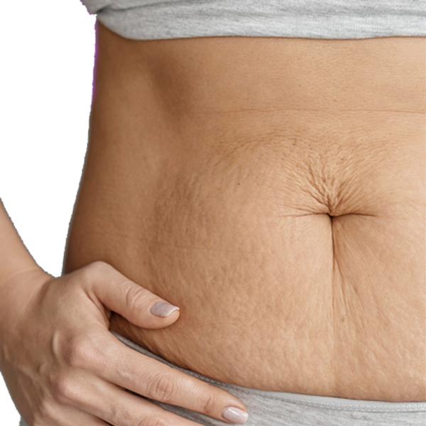 koilioplastiki-square koilioplastiki square